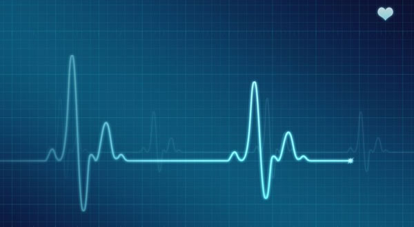 2004-2010 – Eletrocardiograma